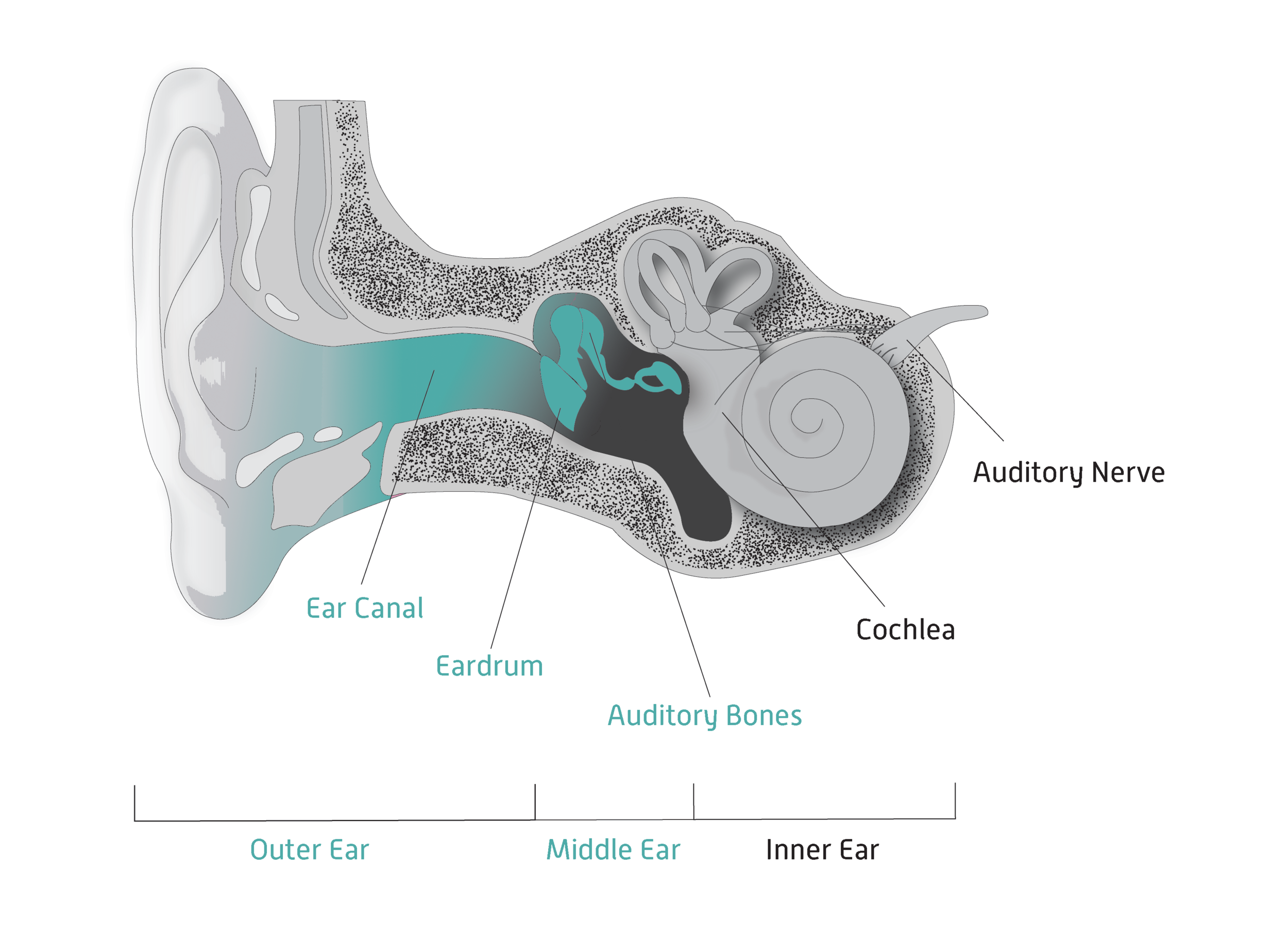 ⁠hearing loss