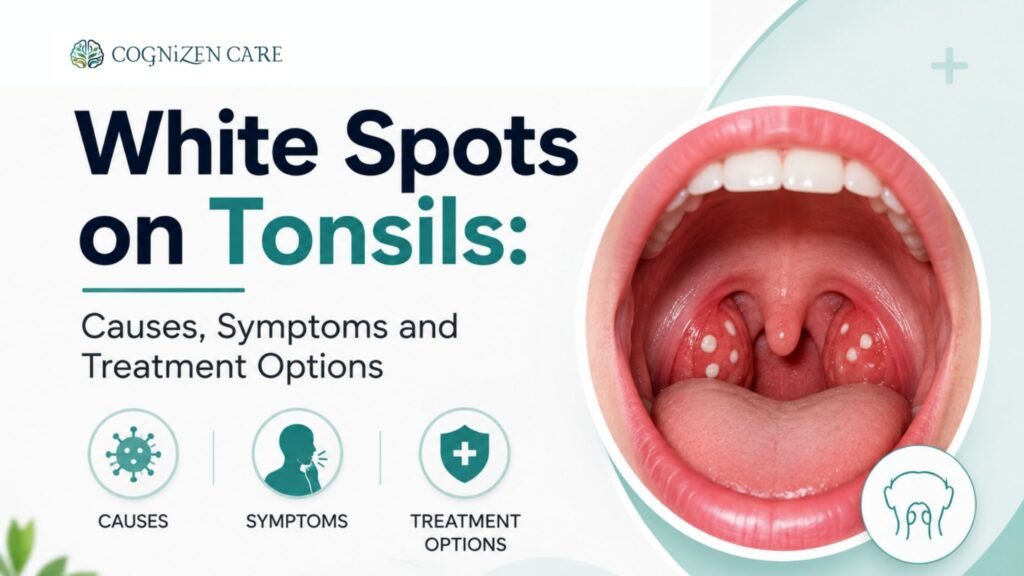 Tonsils