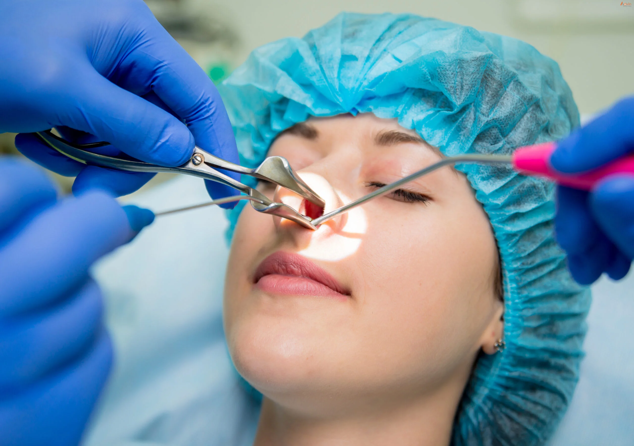 sinus surgery (fess)